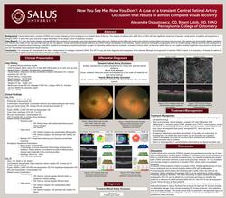 Now You See Me Now You Don’t- A case of a transient Central Retinal Artery Occlusion that results in almost complete visual recovery